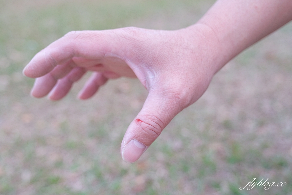 生活分享｜康威多愛膚人工皮，超薄型防水敷料，攜帶方便輕鬆呵護傷口 @飛天璇的口袋