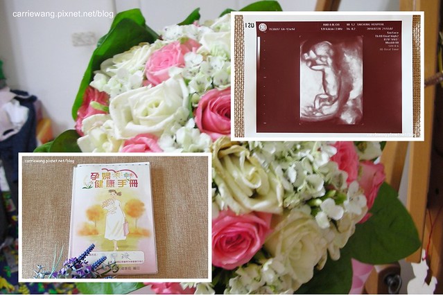 【懷孕日記．12週~20週】我要當媽了。懷孕前三個月 / 懷孕第一次產檢 / 妊娠霜的選購 / 脊髓性肌肉萎縮症檢測 / 羊膜穿刺糖氏症篩檢 / 染色體基因檢測 / 月子中心挑選 @飛天璇的口袋